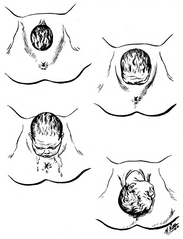 Illustration for article titled The Amazing Muscular Origami That Makes the Vagina So Stretchy
